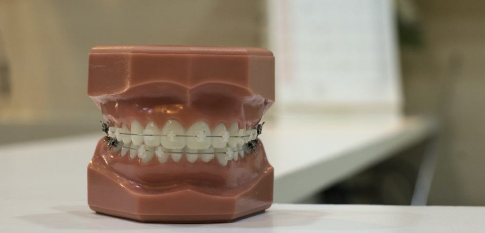 braces