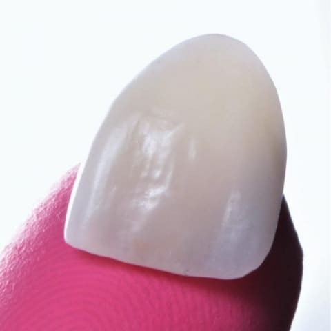 veneers-gold-coast-dentist
