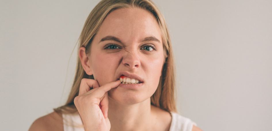 swollen-gums-woman