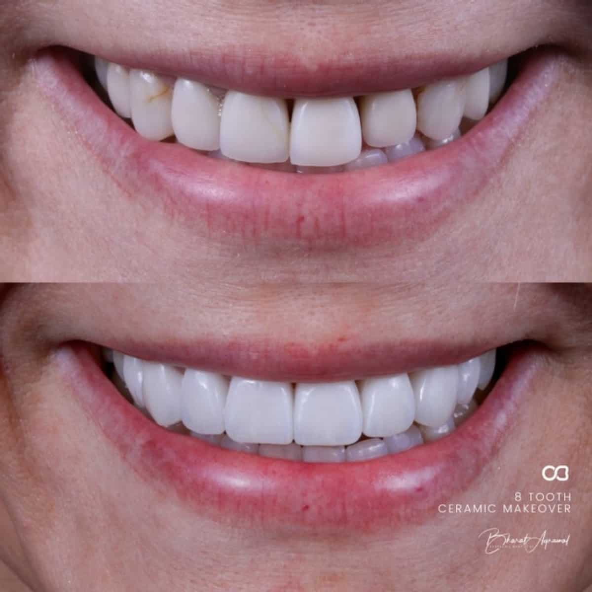 Smile photograph published on the Oasis gallery