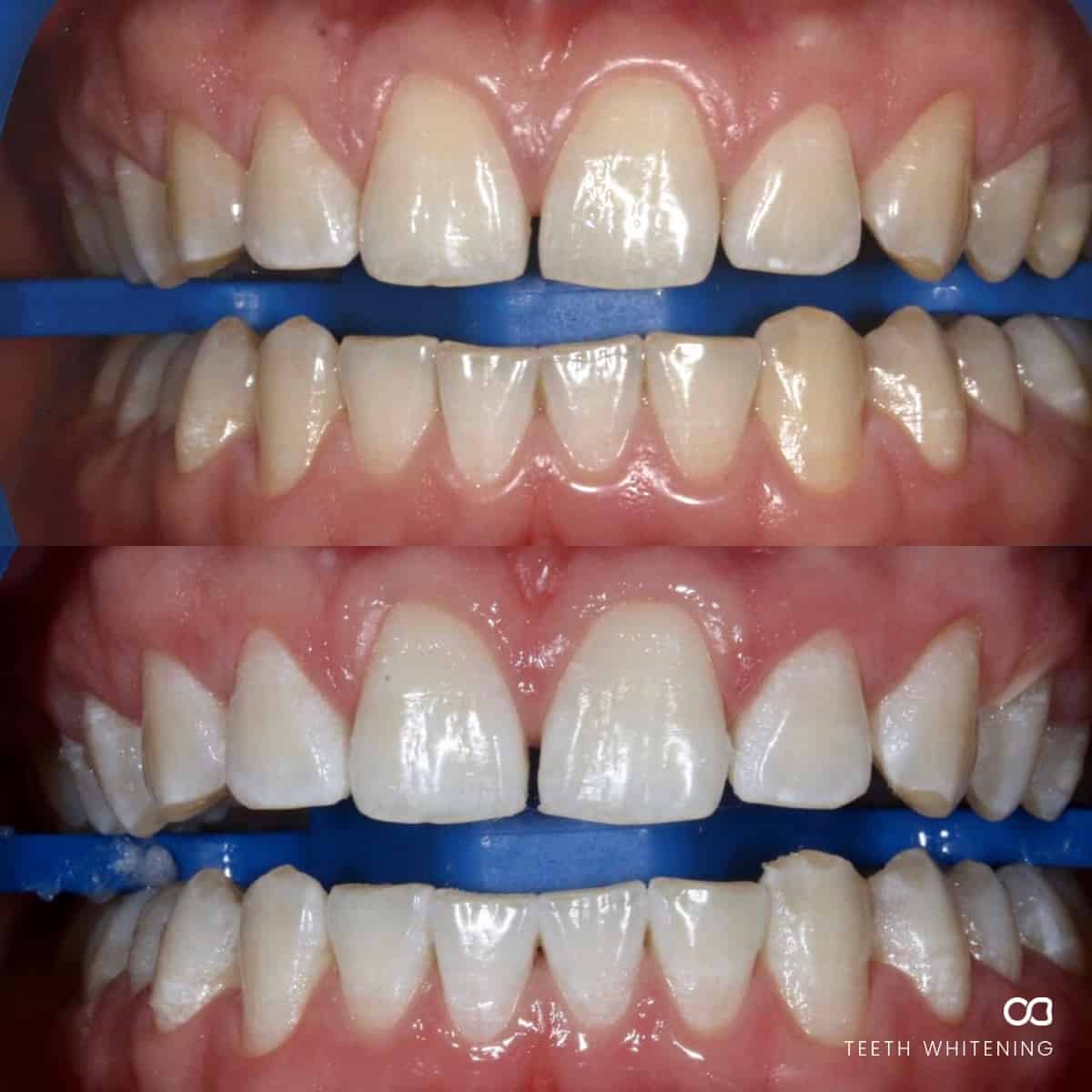 Before and after photograph